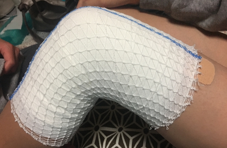 前十字靭帯再建後にとても効果的だった酸素カプセル！帯広で気軽に通えるCAPSULES.24